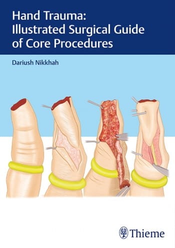 Hand Trauma Illustrated Surgical Guide of Core Procedures.jpg