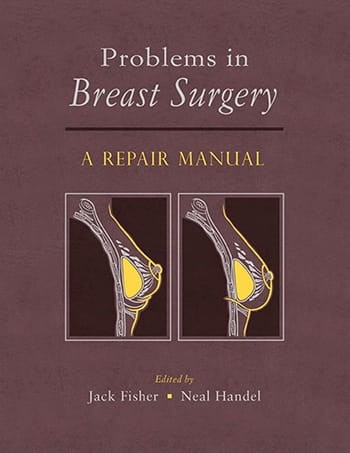 Problems in Breast Surgery A Repair Manual.jpg