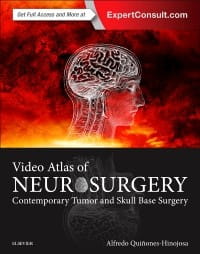 Video Atlas Of Neurosurgery Video Atlas Of Neurosurgery